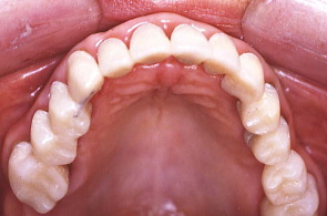 江崎デンタルクリニックトップ・シンボル