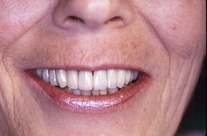 江崎デンタルクリニックトップ・シンボル