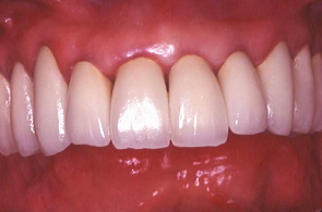 江崎デンタルクリニックトップ・シンボル