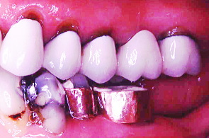 江崎デンタルクリニックトップ・シンボル