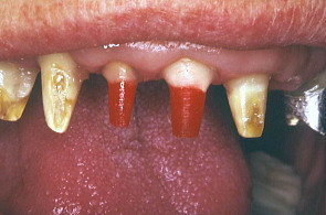 江崎デンタルクリニック、情報公開