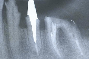 江崎デンタルクリニックトップ・シンボル