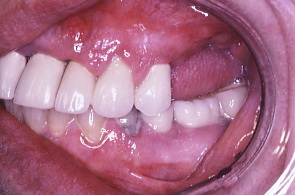 江崎デンタルクリニックトップ・シンボル