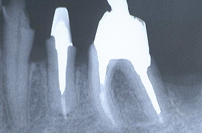 江崎デンタルクリニックトップ・シンボル