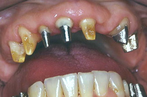 江崎デンタルクリニックトップ・シンボル