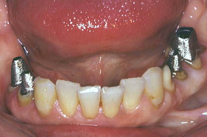 江崎デンタルクリニックトップ・シンボル