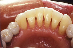 江崎デンタルクリニックトップ・シンボル