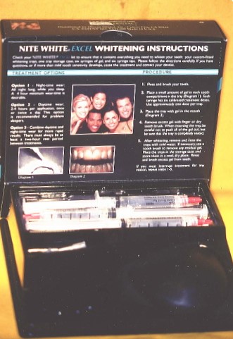 歯周病について説明